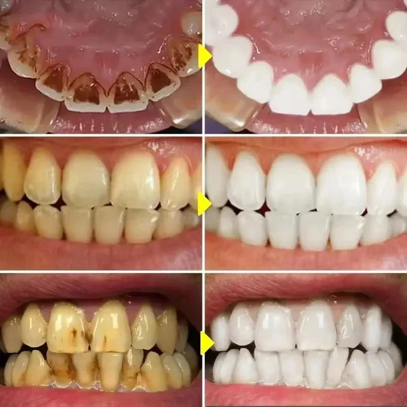 allesxl-32862746
